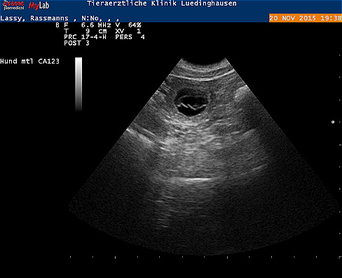 Ultraschall1